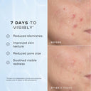 Niacinamide Peptides Serum